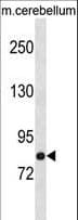 Polyclonal Rabbit anti-Human NSF Antibody (aa668-696, WB)