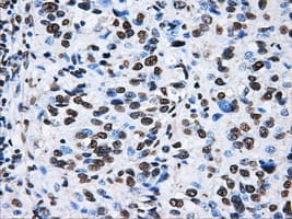 ATP5B / ATP Synthase Beta Antibody (clone OTI4E5)