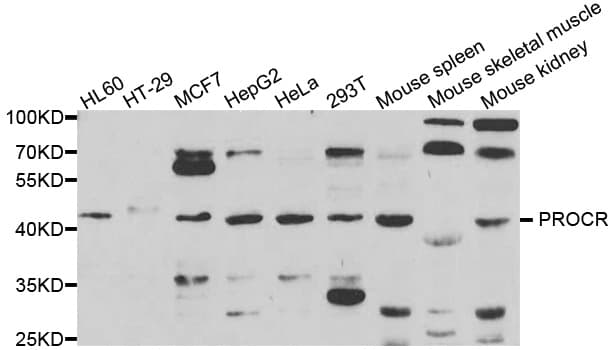 PROCR / EPCR Antibody