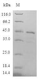 Human LMO4 Protein (Recombinant GST, N-terminus)