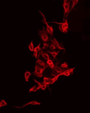 GRIN2B / NMDAR2B / NR2B Antibody