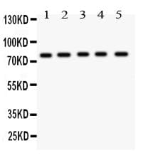 KIF2C / MCAK Antibody (aa531-725)