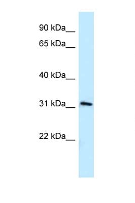 MRPL19 Antibody (C-Terminus)