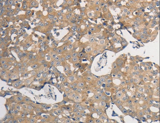 Polyclonal Rabbit anti-Human PP2CB / PPP2CB Antibody (IHC, WB)