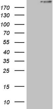 STAB2 / HARE Antibody (aa1914-2194, clone OTI2E12)