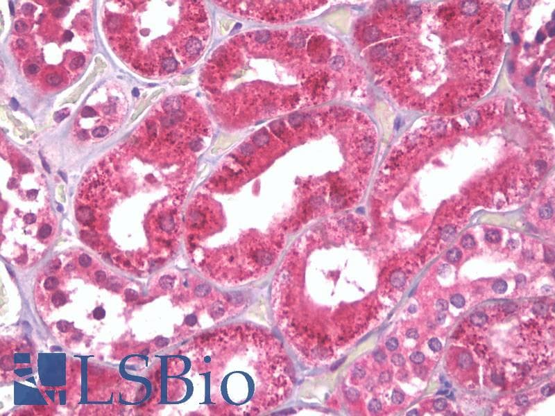 IHC-plus™ PEA15 / PEA-15 Antibody (aa81-130)
