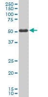 IHC-plus™ Monoclonal Mouse anti-Human SMAD3 Antibody (clone 2C12, IHC, WB)