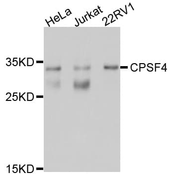 NAR / CPSF4 Antibody