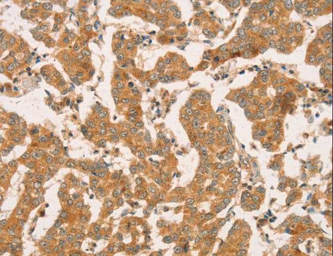 IHC-plus™ Polyclonal Rabbit anti-Human CPB / Carboxypeptidase B Antibody (IHC)