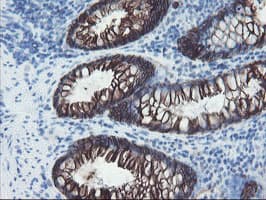 FXYD3 Antibody (clone OTI1F12)