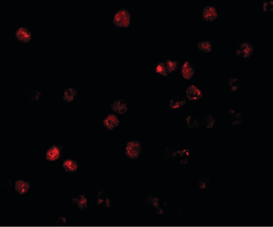 IHC-plus™ Polyclonal Rabbit anti-Human ATP11B Antibody (IHC, IF, WB)