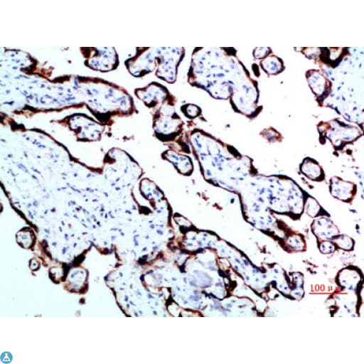 GH / Growth Hormone Antibody