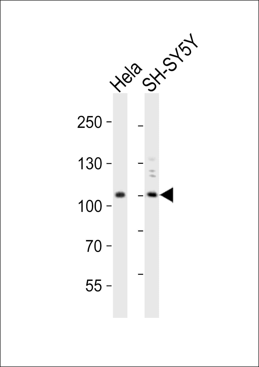 PIK3C3 / VPS34 Antibody (aa24-53)