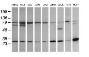RAB21 Antibody (clone OTI6G1)