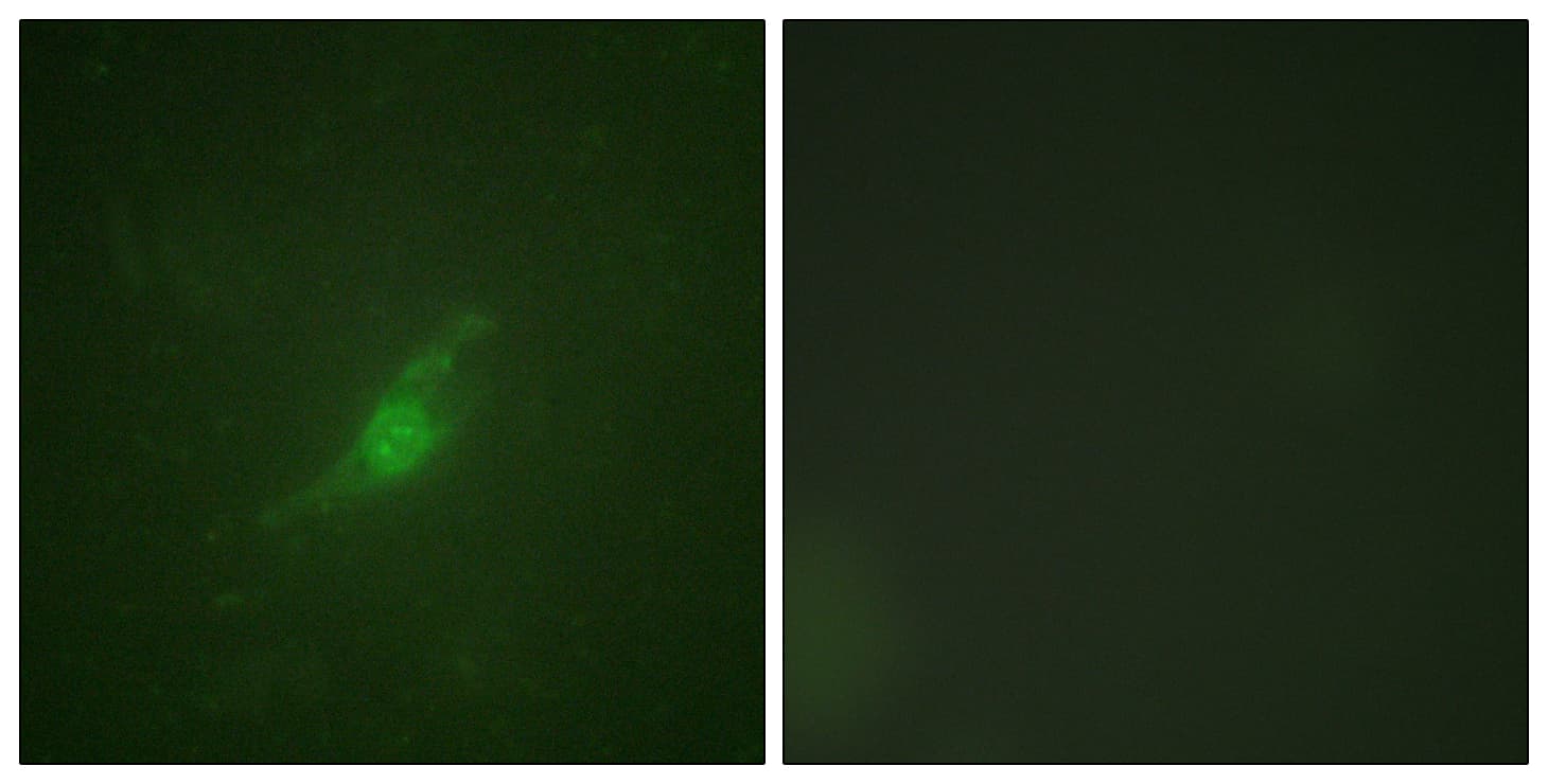 IHC-plus™ Polyclonal Rabbit anti-Human PER2 Antibody (aa636-685, IHC, IF)