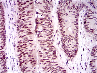 TP53BP1 / 53BP1 Antibody (aa574-773, clone 6B3E10)