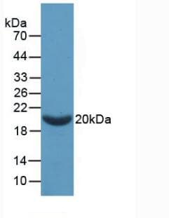 Rat F2 / Prothrombin / Thrombin Protein (Recombinant His, N-Terminal)