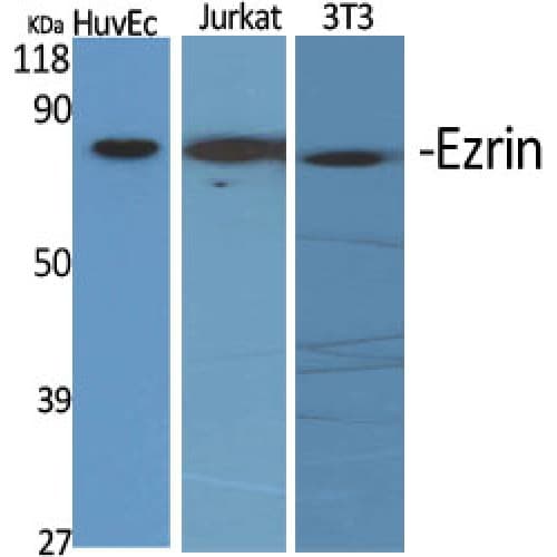 Polyclonal Rabbit anti-Human EZR / Ezrin Antibody (480-560 aa, C-terminal, IHC, WB)