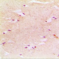 PEX14 Antibody (Internal)