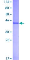 Human IFNA1 / Interferon Alpha 1 Protein (Recombinant GST)