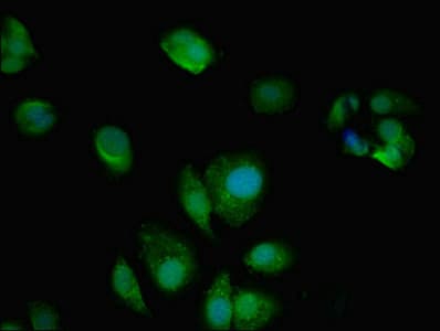 IHC-plus™ Polyclonal Rabbit anti-Human AMPD2 Antibody (IHC, IF)