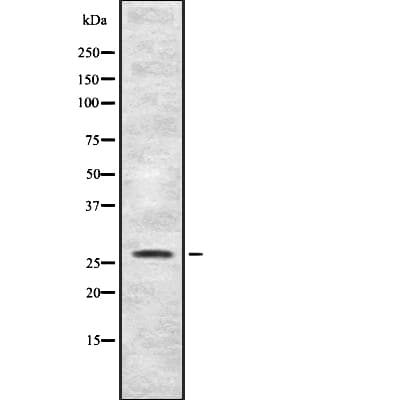 Polyclonal Rabbit anti-Human HBP17 / FGFBP1 Antibody (IHC, WB)