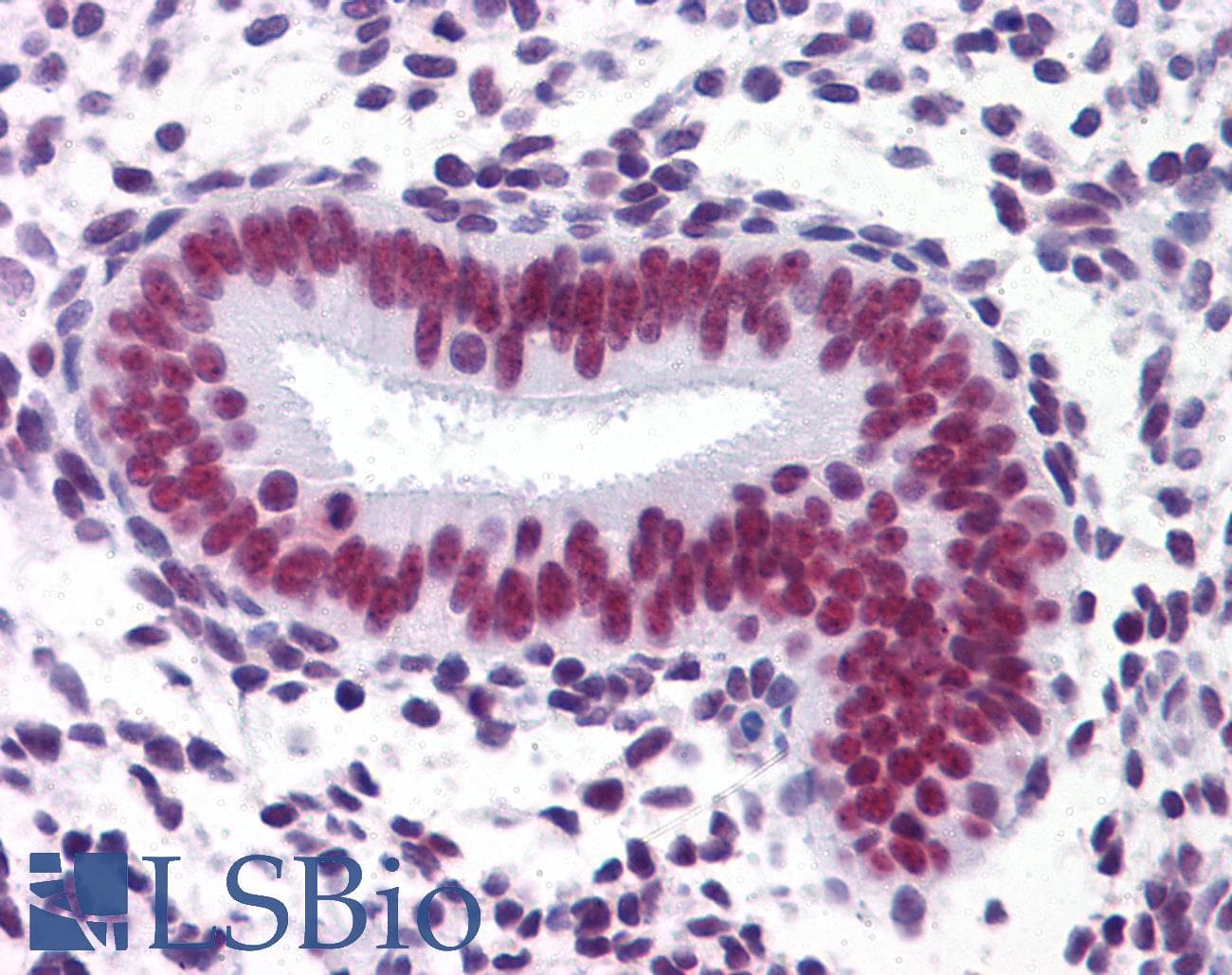 IHC-plus™ CHD4 Antibody (clone 4H4)