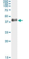 ADORA2A/Adenosine A2A Receptor Antibody (clone 4E4)