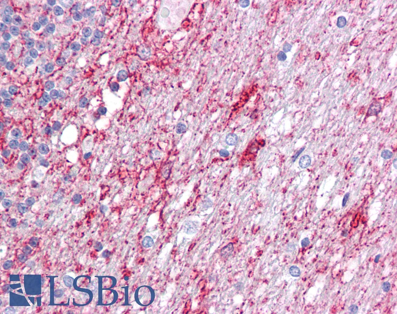 IHC-plus™ Polyclonal Rabbit anti-Human ATG9A Antibody (IHC, IF, WB)