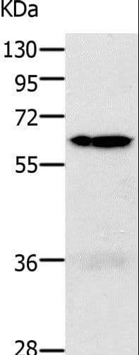 Polyclonal Rabbit anti-Human PAK1 Antibody (IHC, WB)