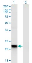 RGS5 Antibody (clone 4E12)