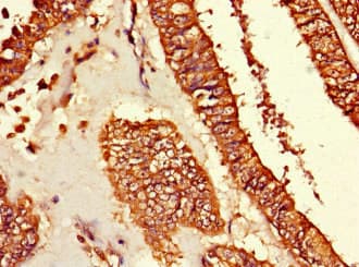 TUBG1 / Tubulin Gamma 1 Antibody