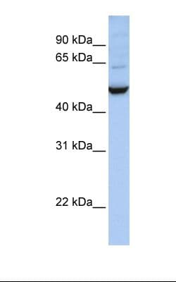 PathPlus™ IDH1 / IDH Antibody (aa290-339)