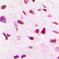 SKP2 Antibody (C-Terminus)