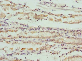 Polyclonal Rabbit anti-Human SCO2 Antibody (IHC)