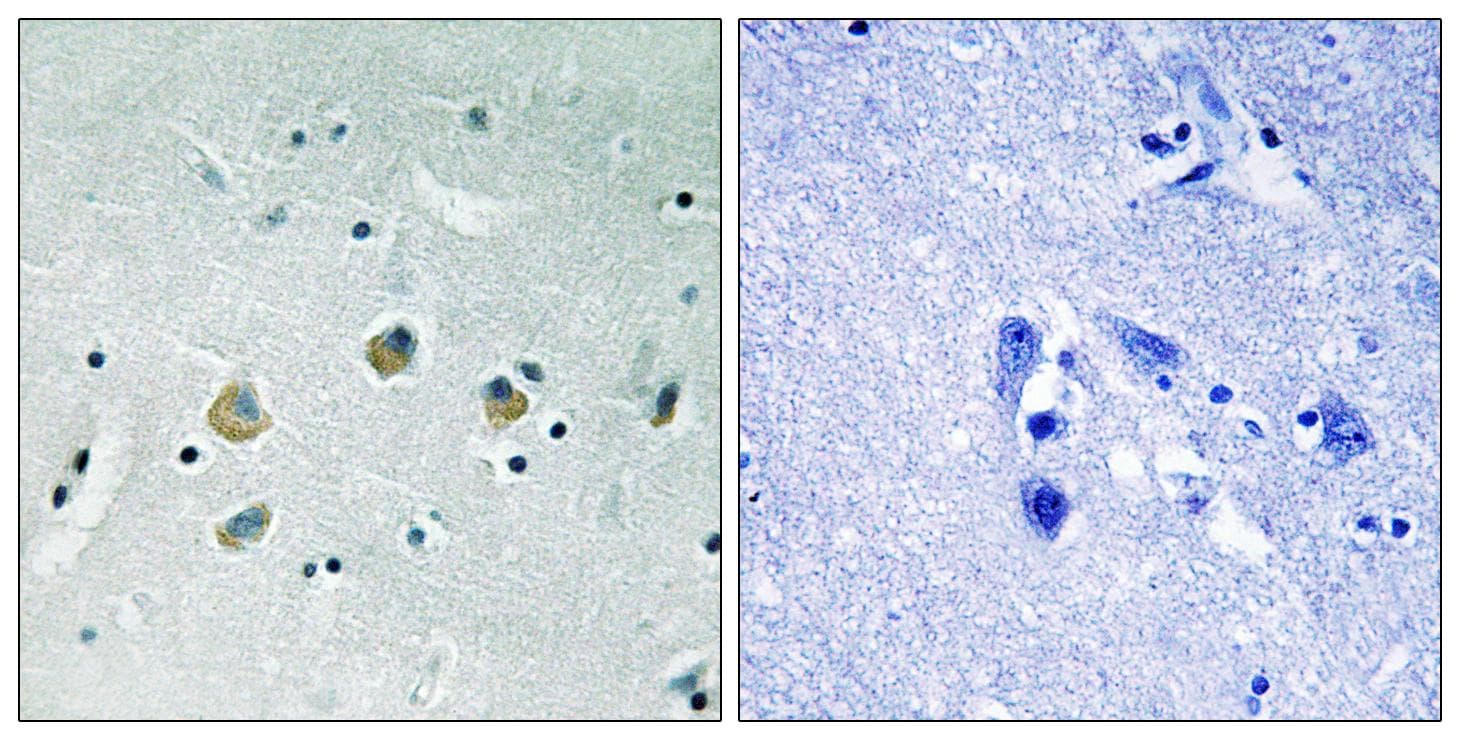 MAP3K8 / TPL2 Antibody (phospho-Ser400)