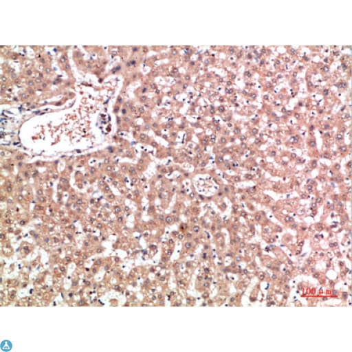 EPG5 / KIAA1632 Antibody