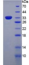 Human Collagen VII Protein (Recombinant His, N-Terminal)