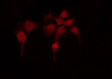 MEN1 / Menin Antibody