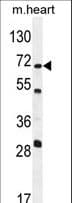 NT5C1B Antibody (aa3-32)