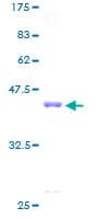 Human RPS16 / Ribosomal Protein S16 (Recombinant GST)