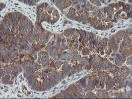 COMMD1 Antibody (clone OTI3B3)