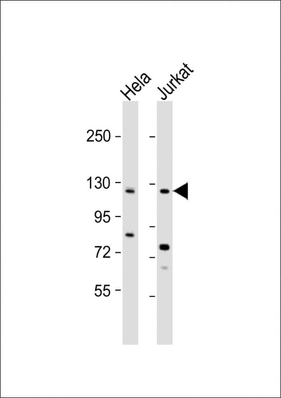 SRGAP3 Antibody (aa956-989)