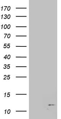 PathPlus™ B2M / Beta 2 Microglobulin Antibody (aa21-119, clone OTI1A7)