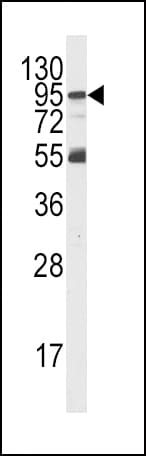 PIK3R5 Antibody (aa392-421)