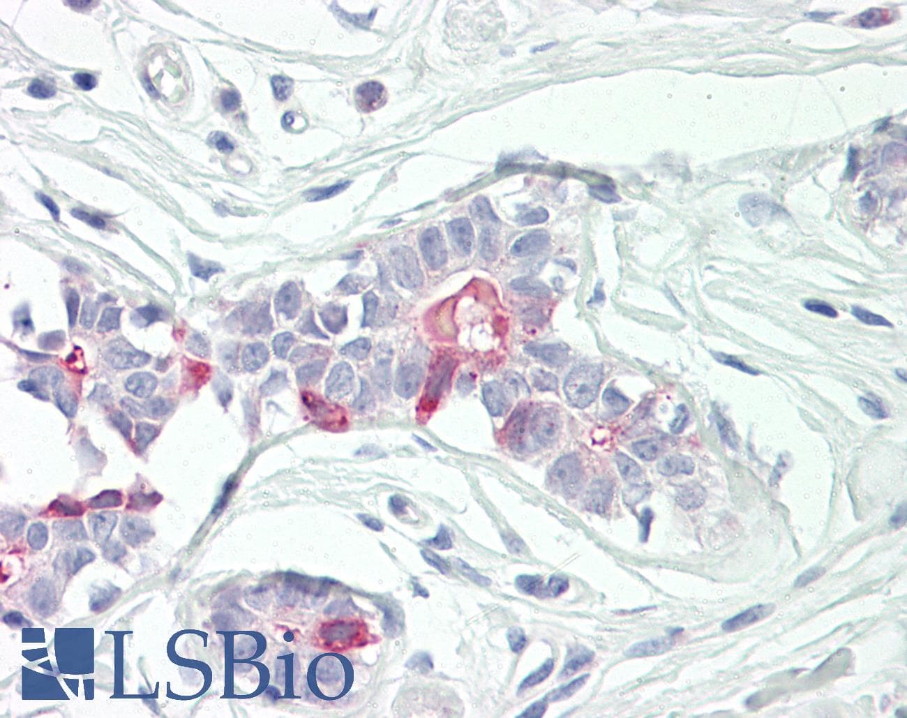IHC-plus™ TNFAIP8 / SCC-S2 Antibody (aa31-80)
