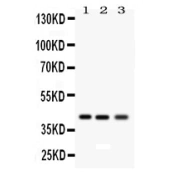 AGER / RAGE Antibody (aa91-120)