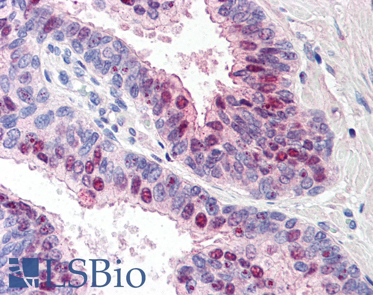 IHC-plus™ TRM3 / TARBP1 Antibody