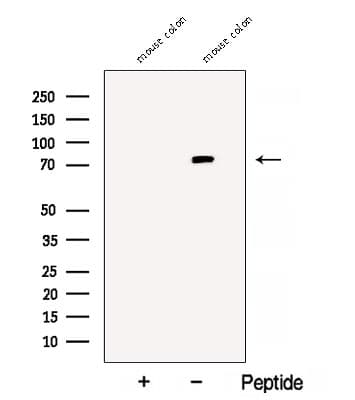 VMD2L3 / BEST3 Antibody