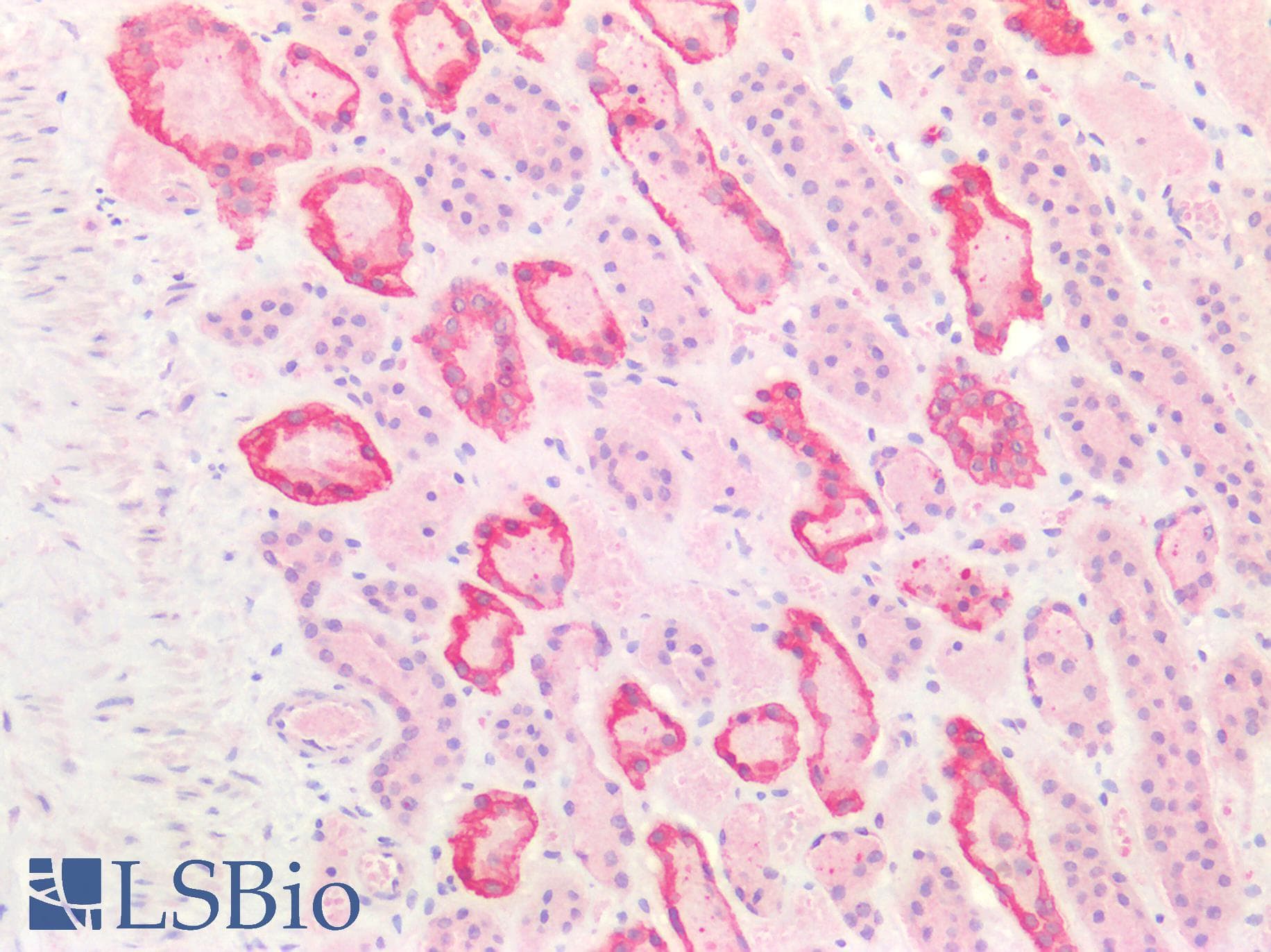 PathPlus™ KRT8 / CK8 / Cytokeratin 8 Antibody (aa2-483)